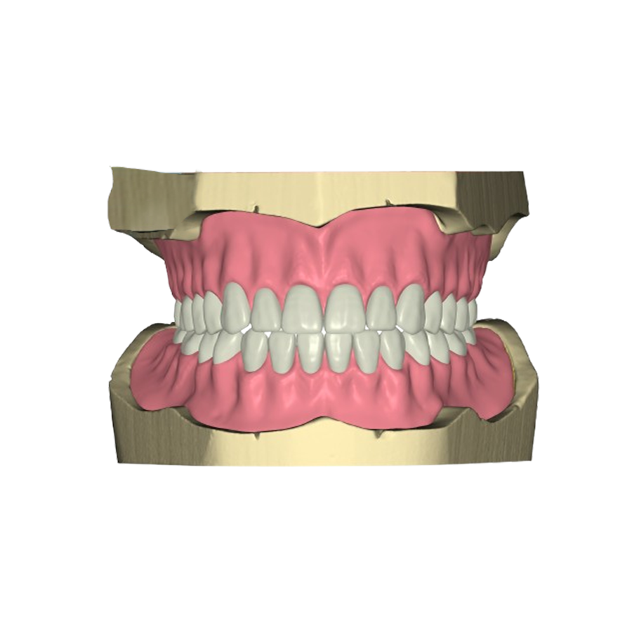 iPDenture FD
